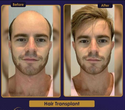 Slider image (4) Estherian Clinic